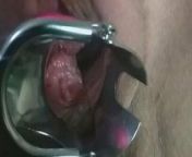 Massive squirt on the camera lens after speculum and double penetration from quay len lam tinh