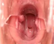 OhMiBod Creamy Cum Speculum Deep Inside Cervix from ohmibod with someone