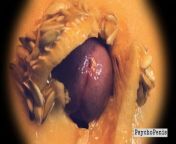Defloration. PsychoPenis busts her melon from penis inside vagina defloration pg