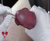 Perfect extraction of sperm directly from the urethra. Close-up of the glass straw sounding. from peehole inflation domina