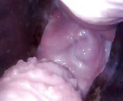 Vagina endoscope from japanese endoscope camera inside cervix cam into pussy